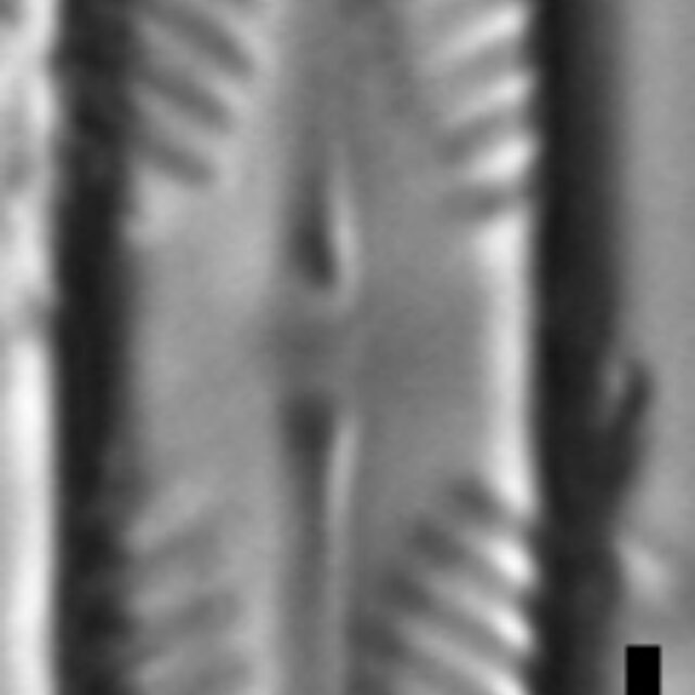 Pinnularia divergentissima subrostrata LM7