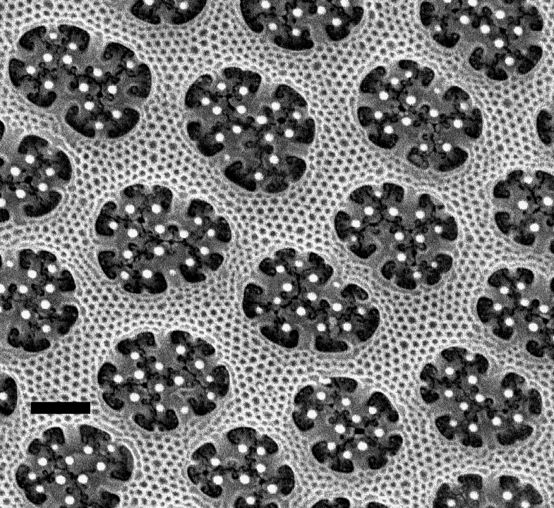 Arachnoidiscus ornatus volae 1µm 1