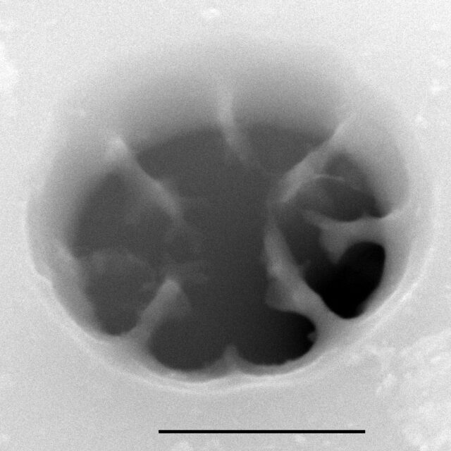 A Crassipunctata Areola SEM