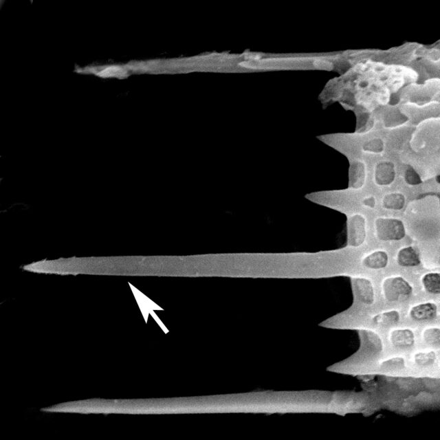 A Granulata Separationspines 1