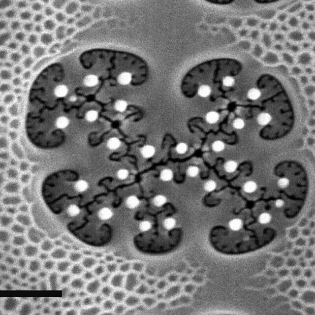 Arachnoidiscus ehrenbergii vola 1µm