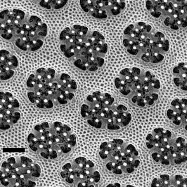 Arachnoidiscus ornatus volae 1µm 1