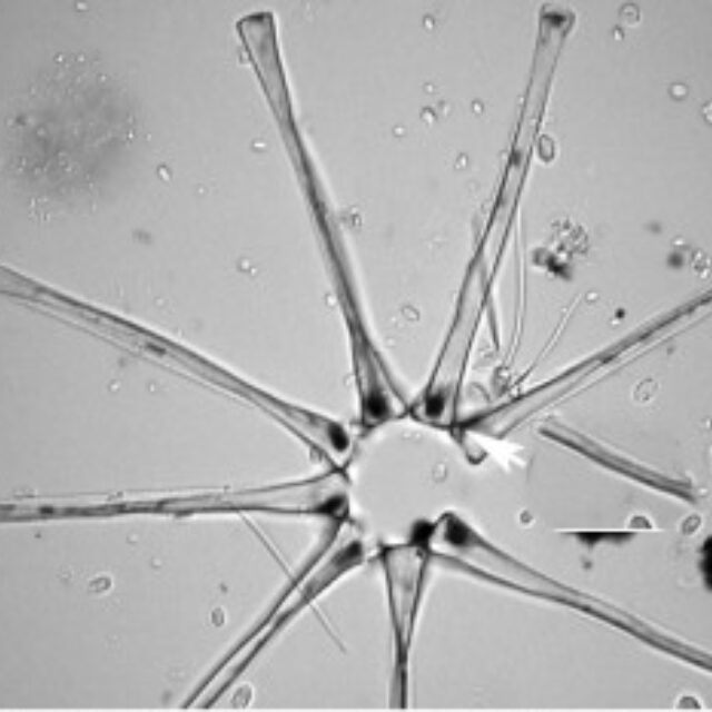 Asterionella Guide Stellate