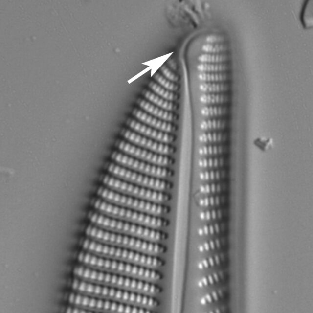 Encyonema Distal