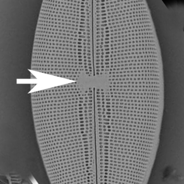 Mastogloia Lateral Sternum