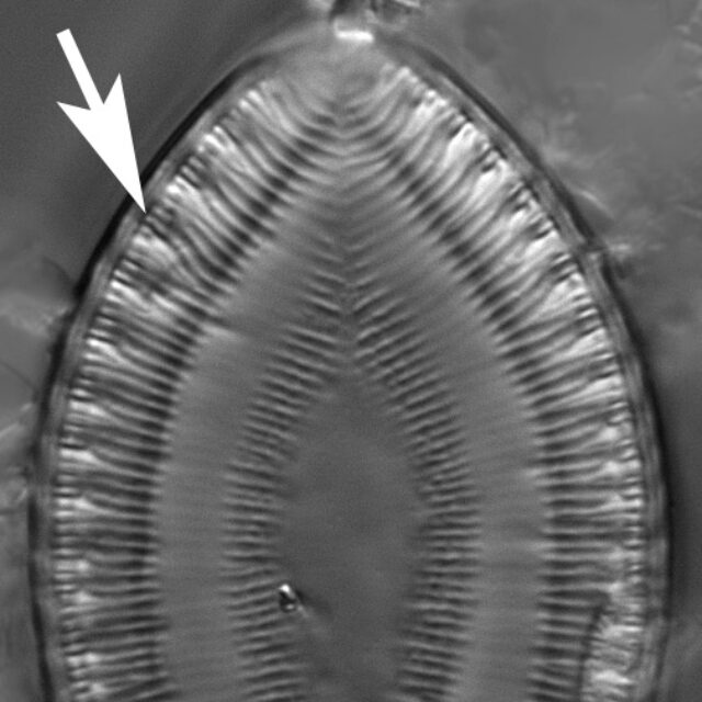 S Ovalis Fibulae