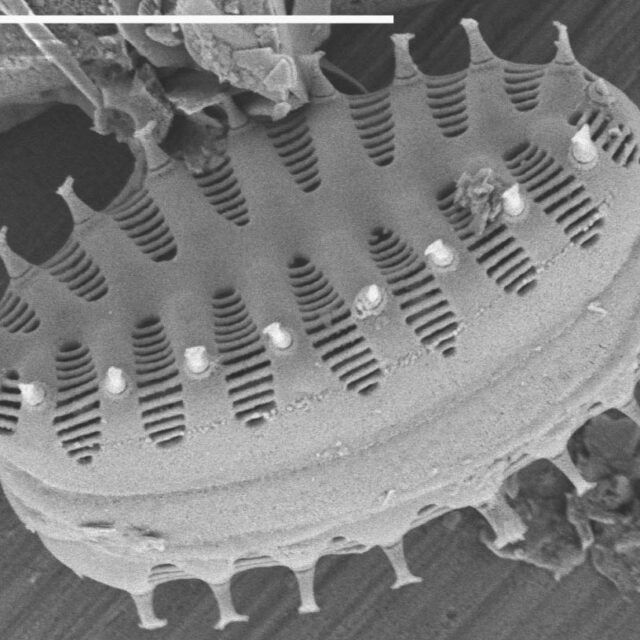 Staurosirella Pinnata Gsn92019  Cook 2001 Scale 5 Microns 7 1039