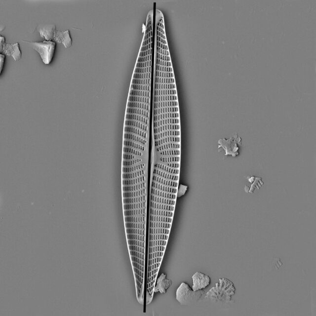 Apical Axis