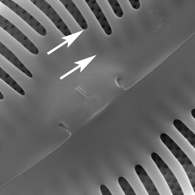 Axial Plate Copy