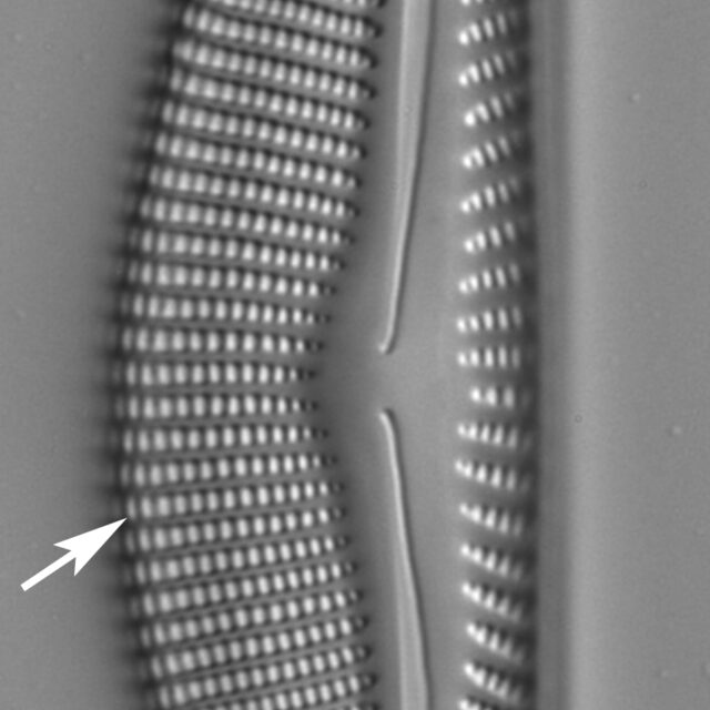 Encyonema Dorsal Margin