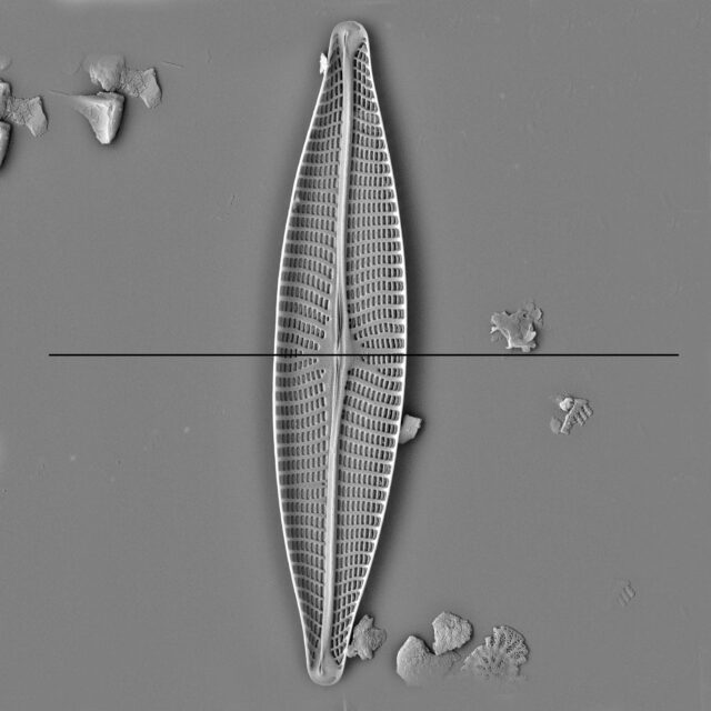 Transapical Axis