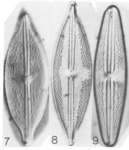 Anomoeoneis Sphaerophora Fo Sculpta Schmid