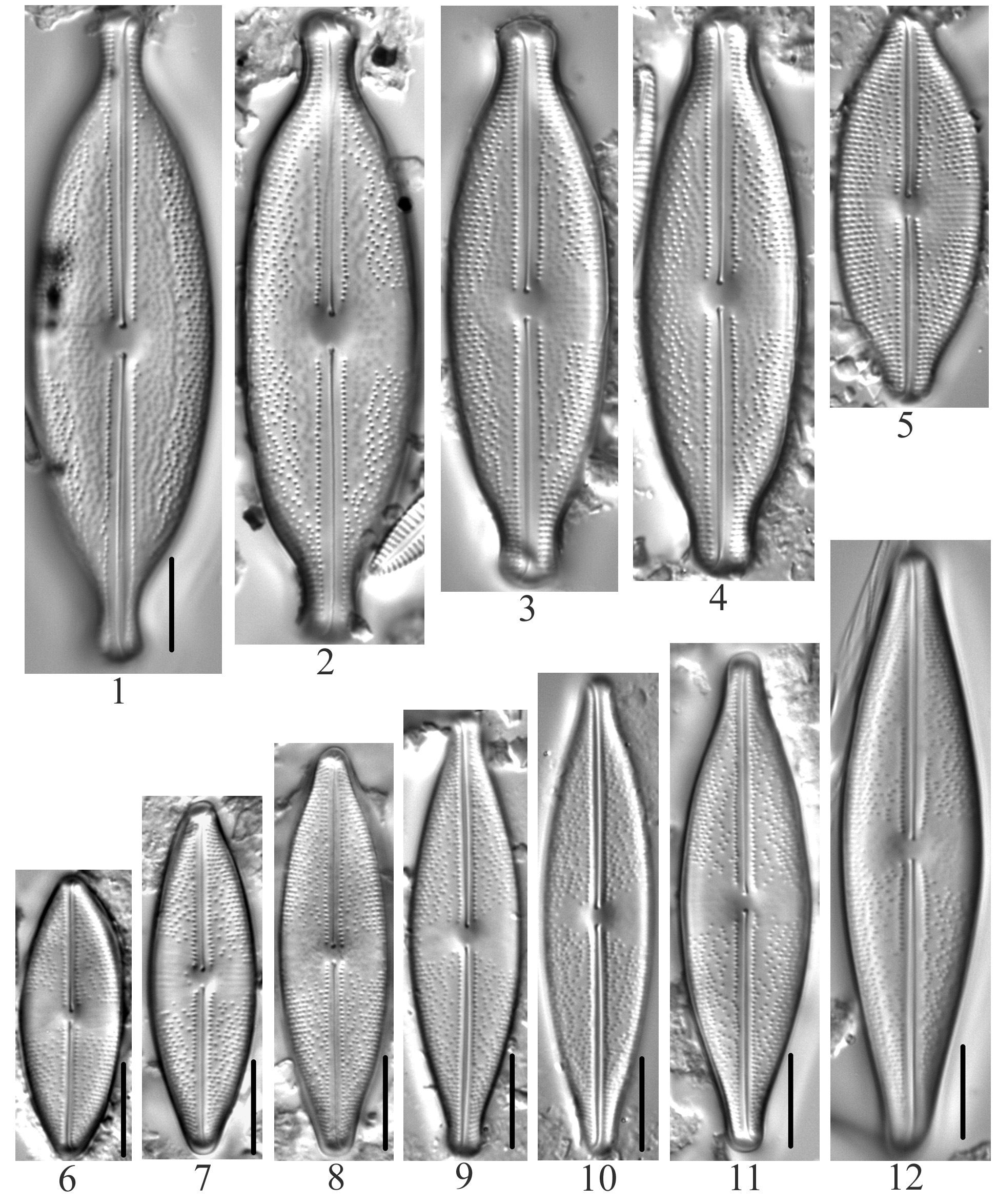 Anomoeoneis Sphaerophora Guentheri