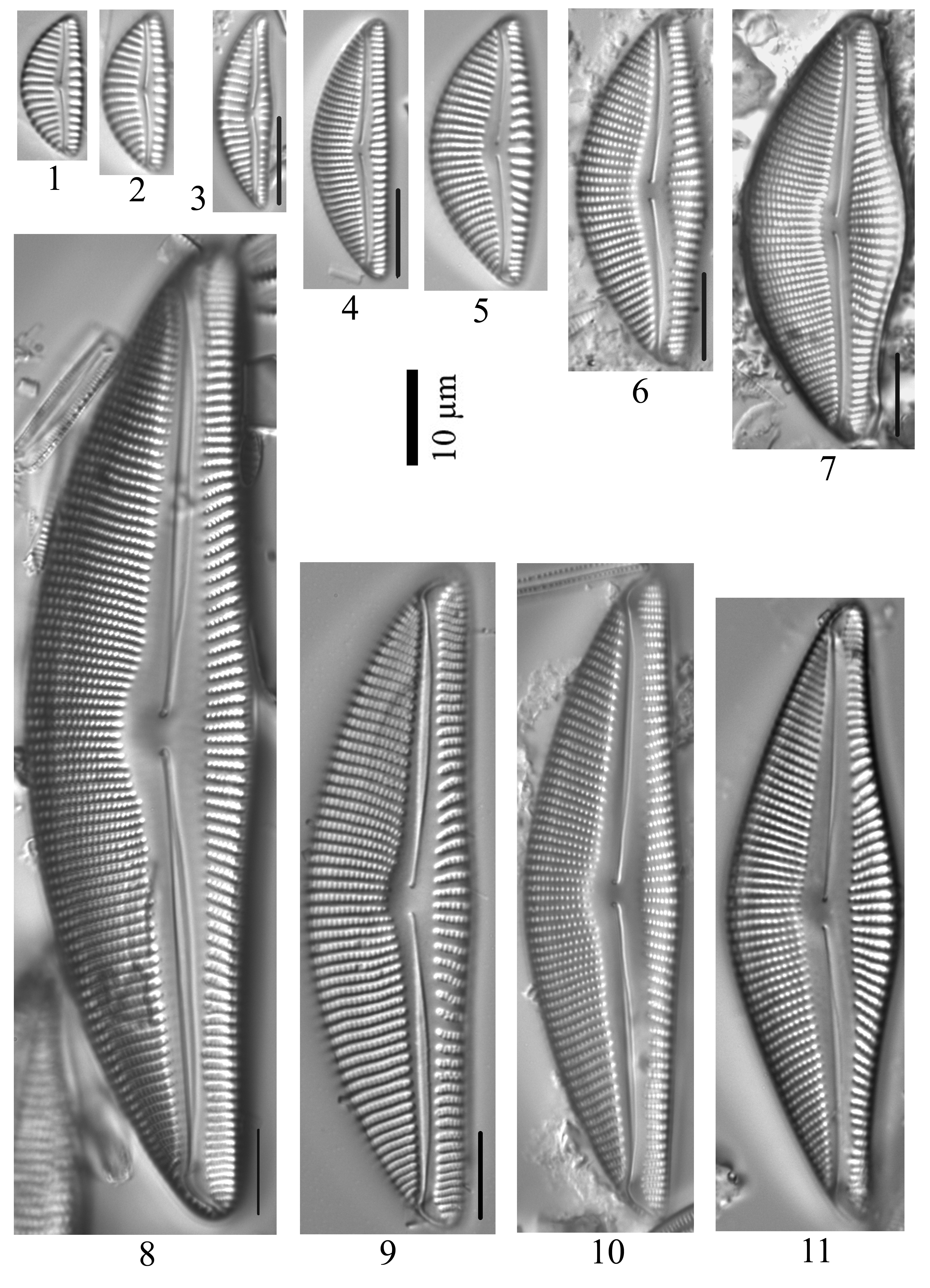 Encyonema Muelleri Sensu Lato