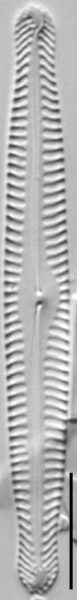 Pinnularia gibbiformis ANSP GC112464a 01