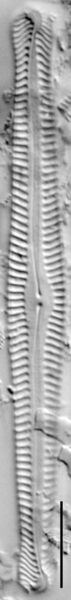 Pinnularia gibbiformis ANSP GC112464a 03