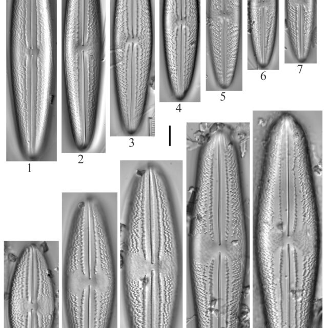 Anomoeoneis Costata Sensulato 1