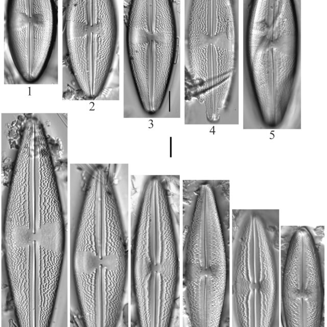 Anomoeoneis Costata Sensulato 2