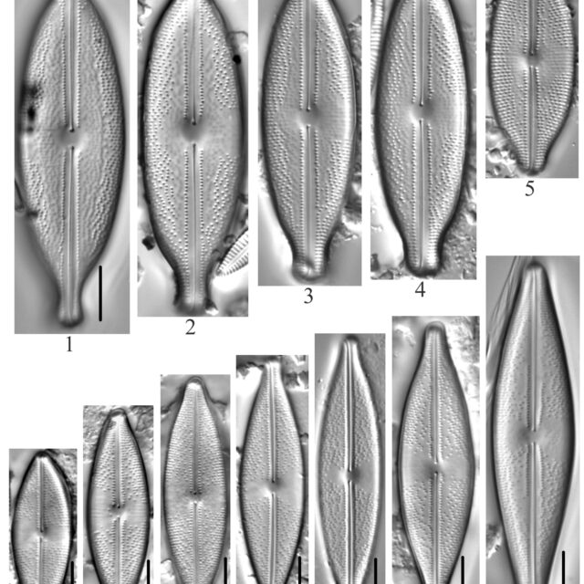 Anomoeoneis Sphaerophora Guentheri