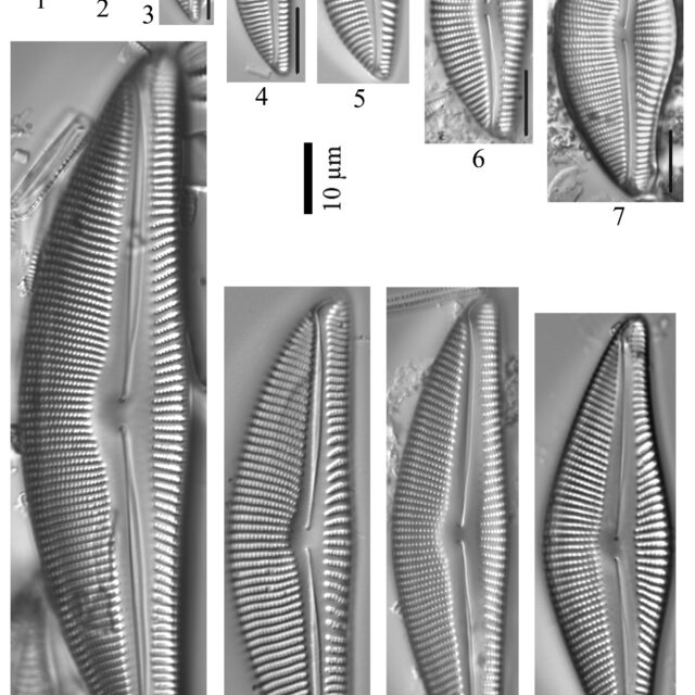 Encyonema Muelleri Sensu Lato