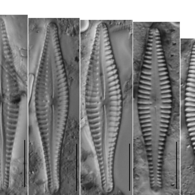 Gomphonema Gibba Plate  Fl