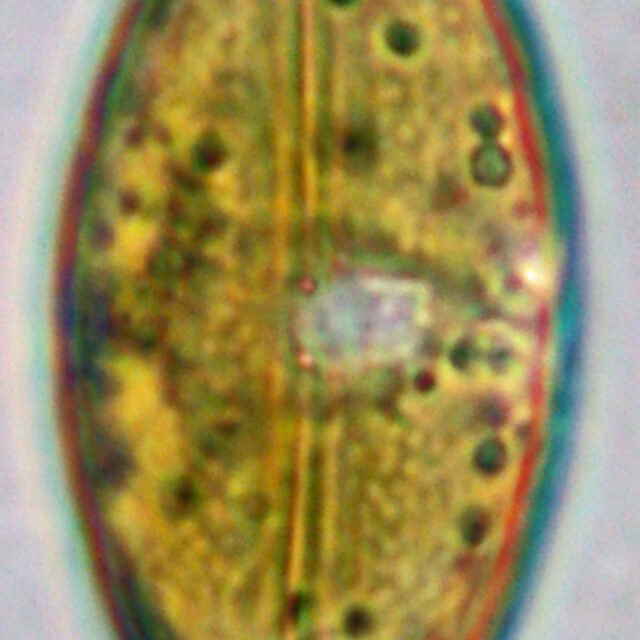 Lakeside Micrographs 2 063  Anom Sph  Sandspit  Mbay