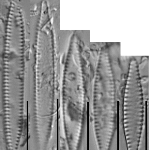 Pseudostaurosira microstriata2