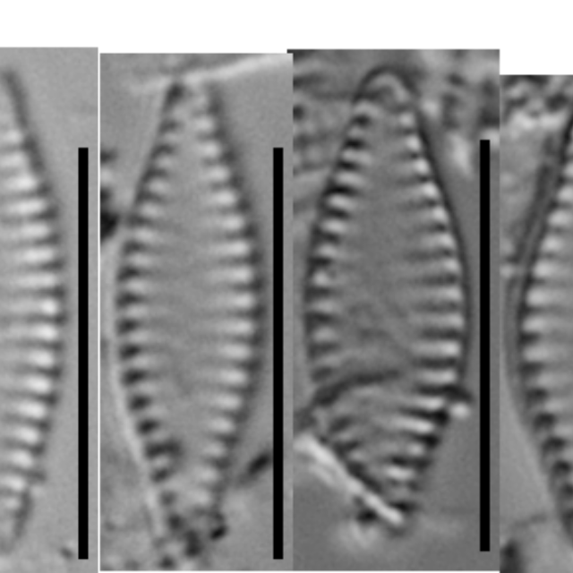 Pseudostaurosira microstriata A