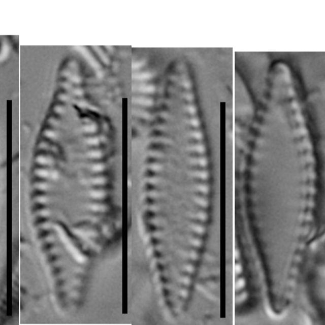 Pseudostaurosira microstriata B