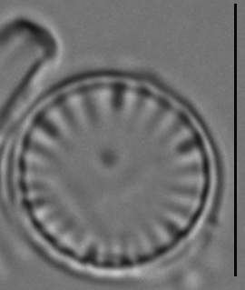 Cyclotella atomus LM1