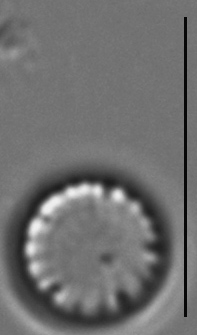 Cyclotella atomus LM4