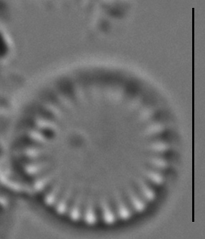 Cyclotella atomus LM5