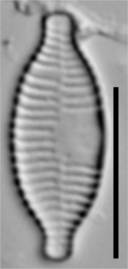 Fragilaria recapitellata LM3