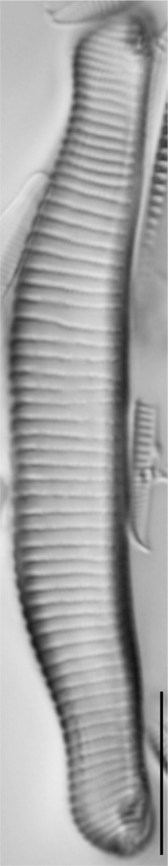 Eunotia implicata LM1