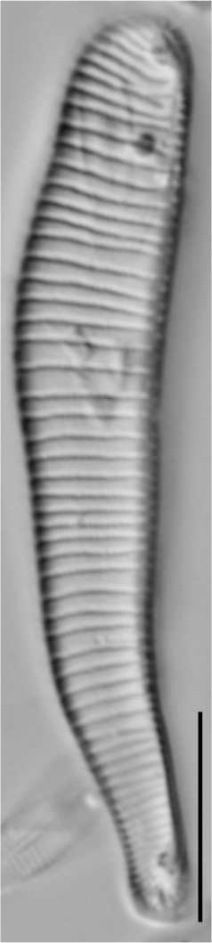 Eunotia implicata LM3