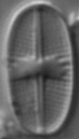 Psammothidium subatomoides LM1