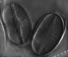 Psammothidium subatomoides LM7