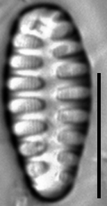 Staurosirella martyi LM11