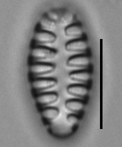 Staurosirella martyi LM8