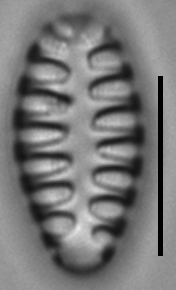 Staurosirella martyi LM9