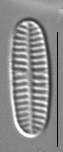 Rossithidium nodosum LM1