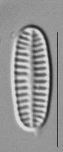 Rossithidium nodosum LM3