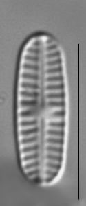 Rossithidium nodosum LM5