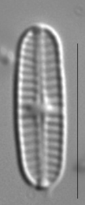 Rossithidium nodosum LM7