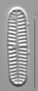 Rossithidium nodosum LM9