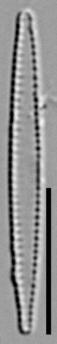 Fragilaria pennsylvanica LM2