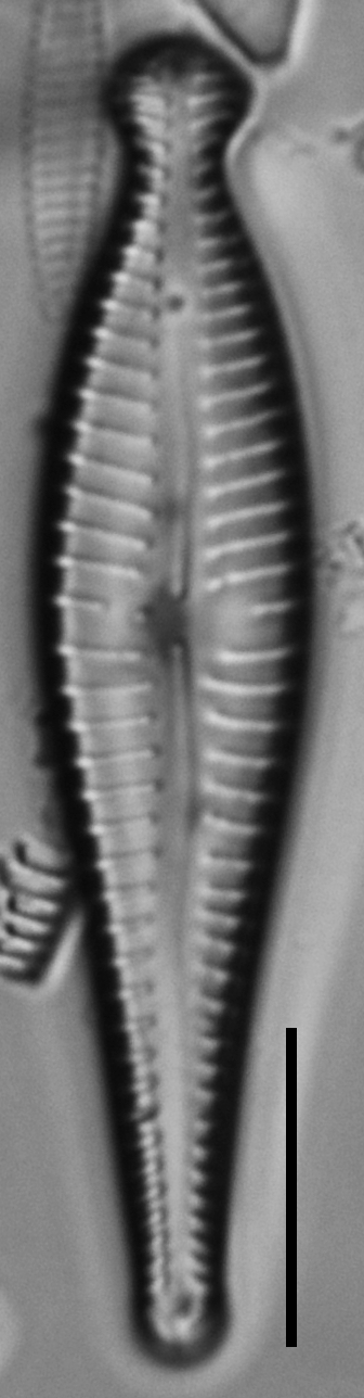 Gomphonema pseudosphaerophorum LM6