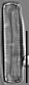 Eunotia microcephala LM6