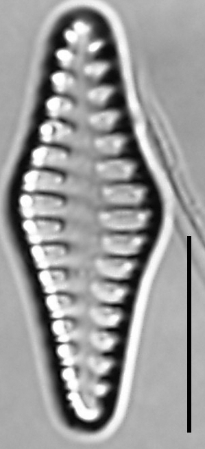Staurosirella rhomboides LM3