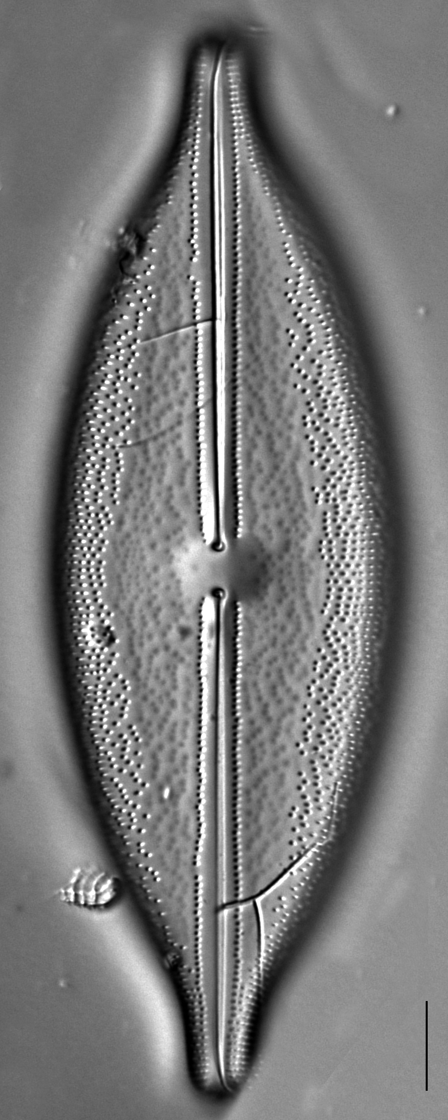 Anomoeoneis Sphaerophora F Sculpta Ill 2018 12 Image2